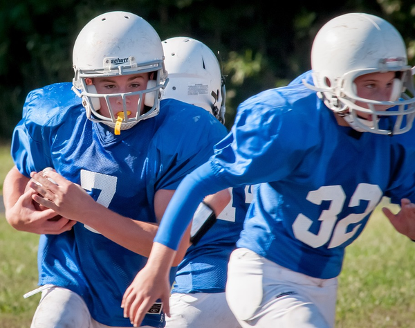 Things You Need To Know About Sport Mouthguards